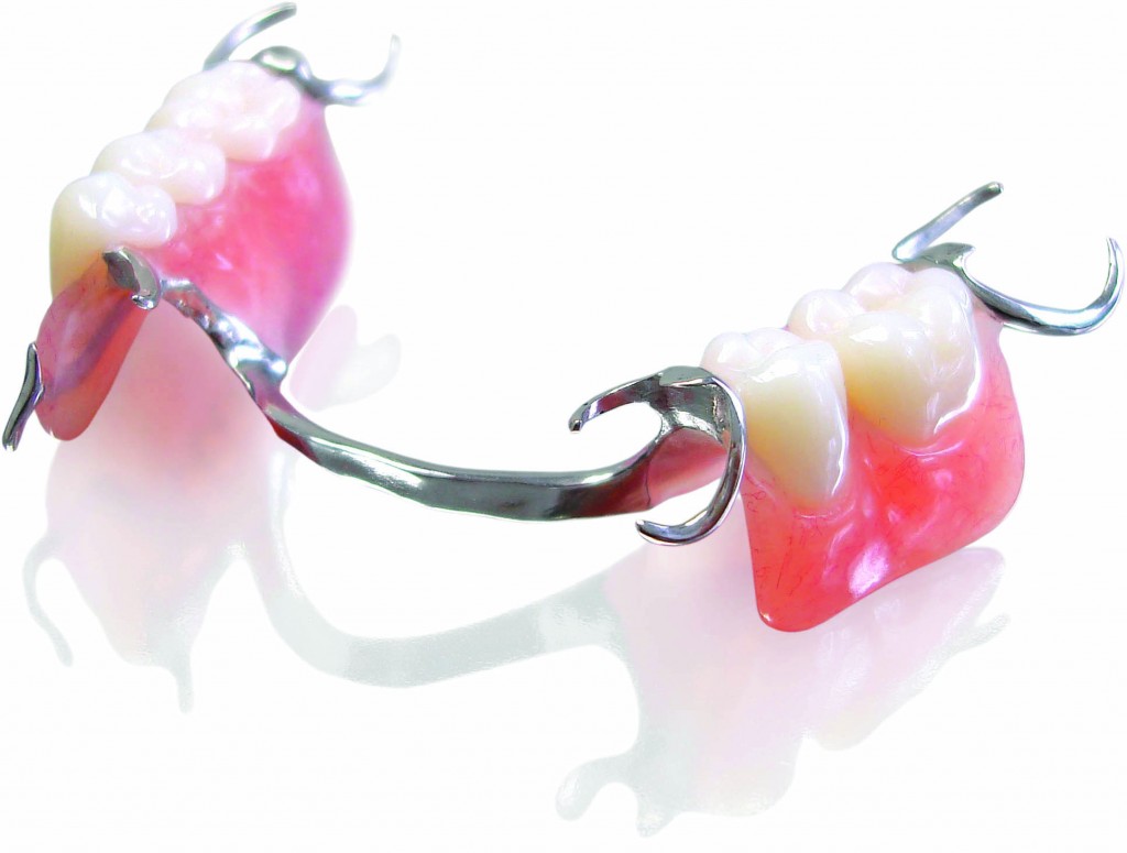 Partial-Dentures