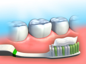 Fluoride
